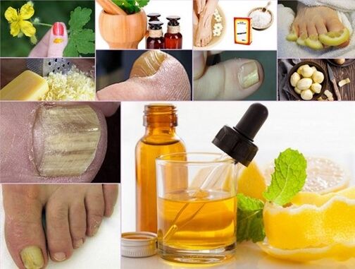 Remedios caseros para tratar hongos en las uñas de los pies.