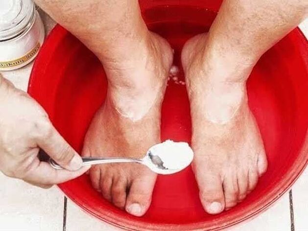 baños de soda para hongos