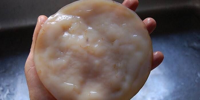 Kombucha para hongos en las uñas