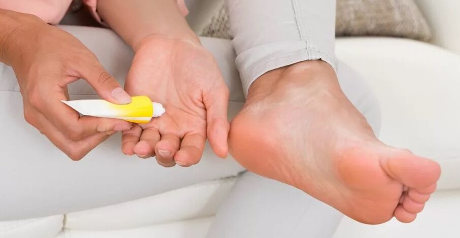 Ungüentos contra hongos en los pies.
